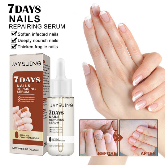 Jaysuing 7 Day Nail Care Essence Grey Nail, Hand, Foot And Nail