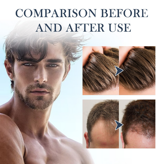 East Moon™ Hair Strengthening Shampoo – Power & Purity for Men